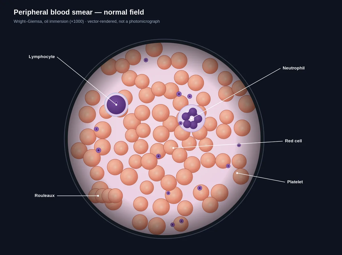 Peripheral blood smear — normal field