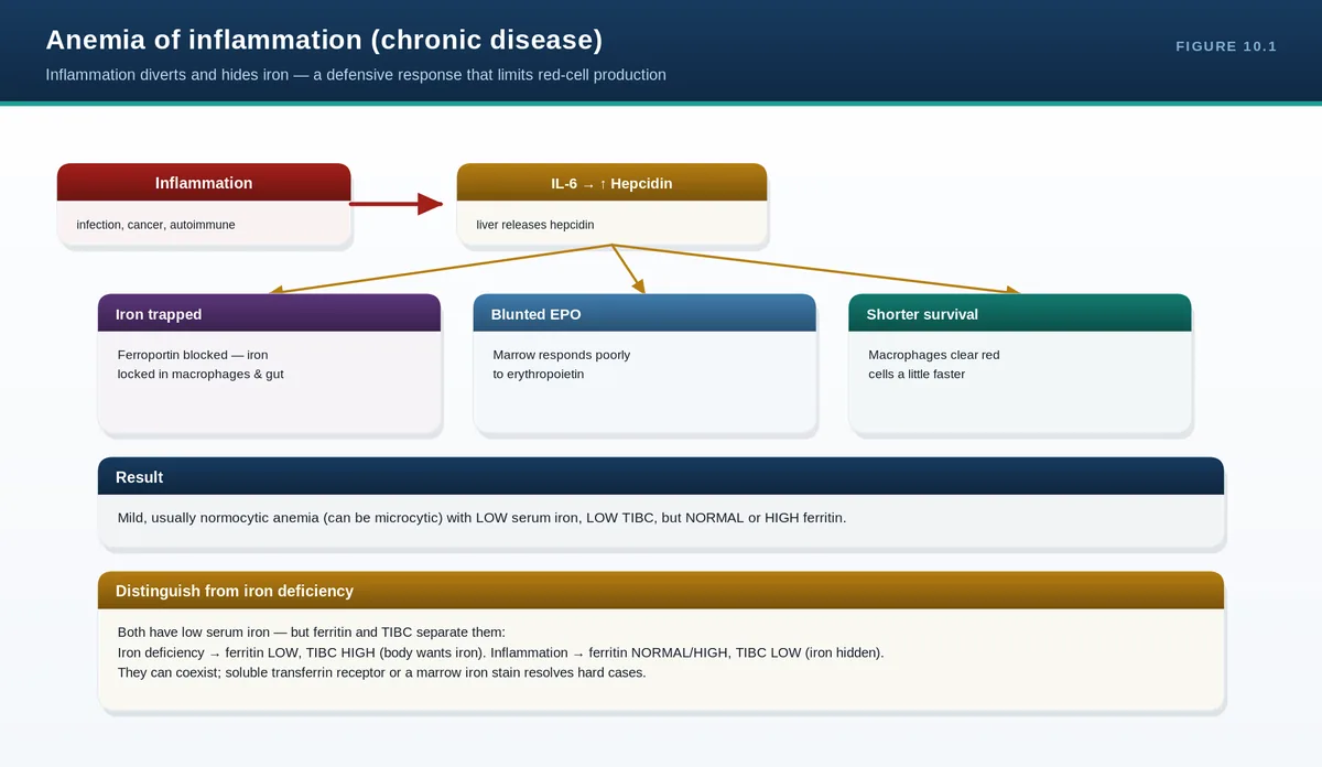 Anemia of inflammation