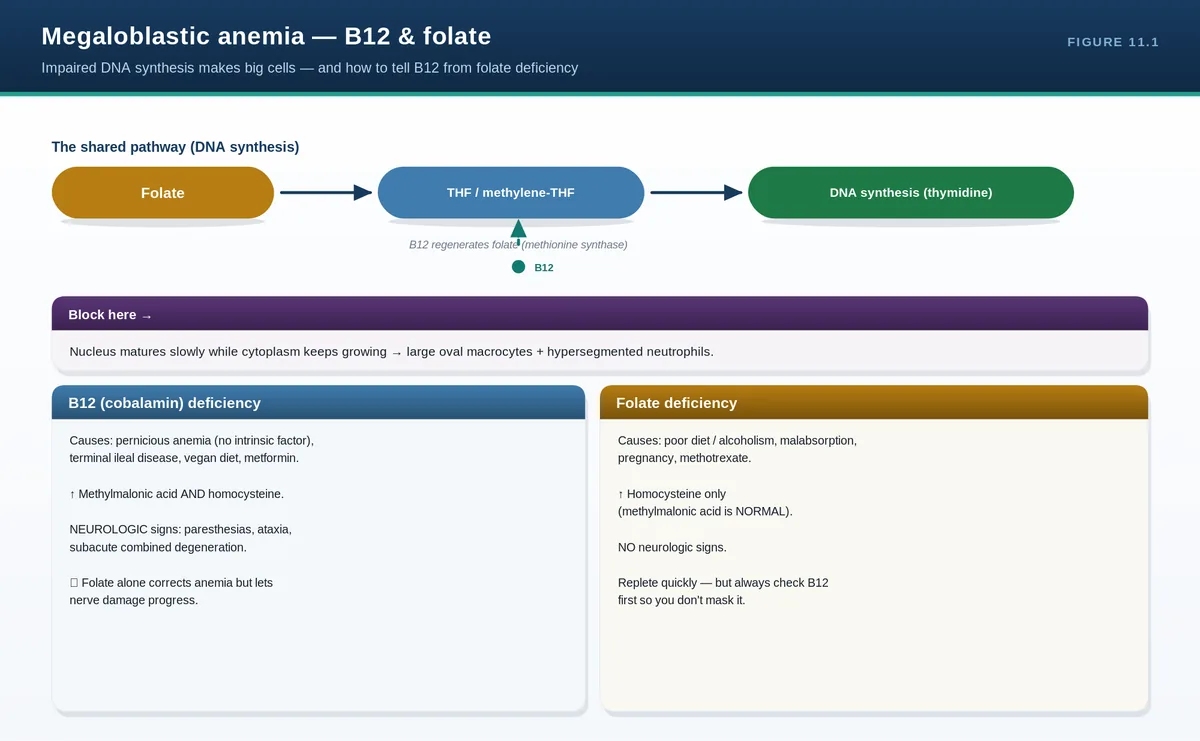 Megaloblastic anemia — B12 & folate