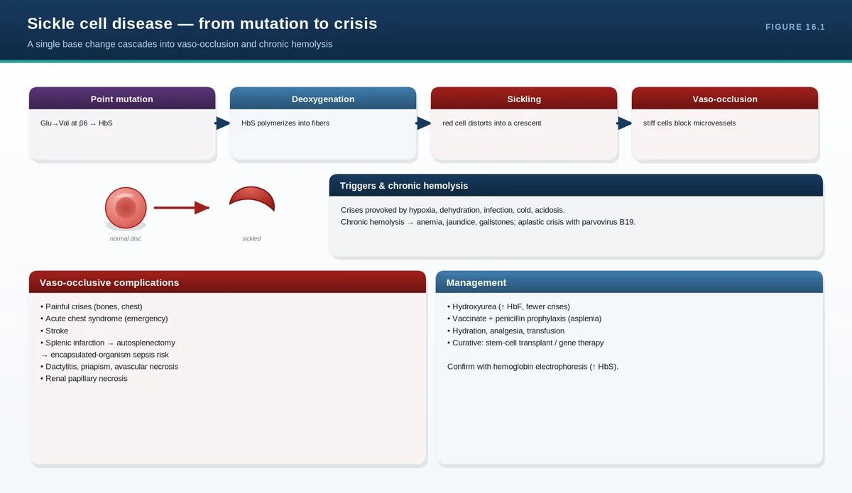 Sickle cell disease
