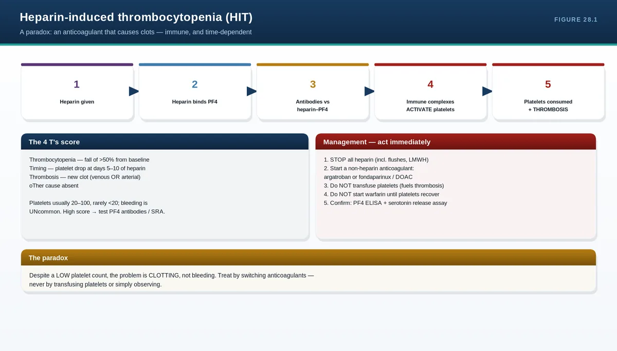 Heparin-induced thrombocytopenia (HIT)