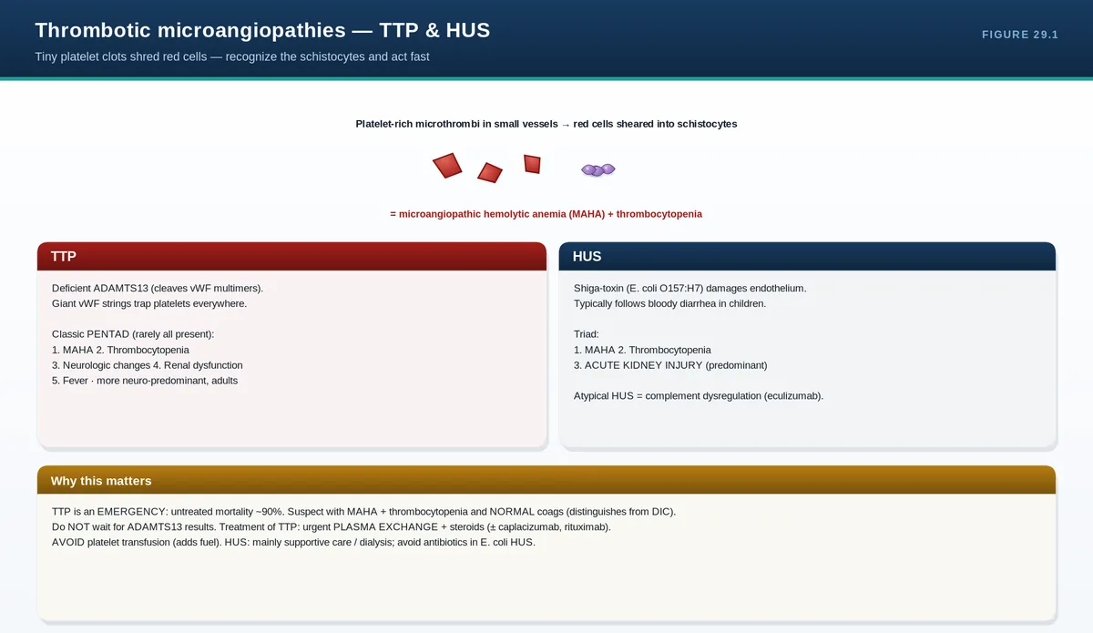 Thrombotic microangiopathies — TTP & HUS