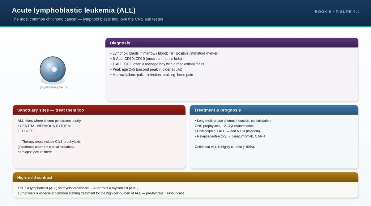 Acute lymphoblastic leukemia (ALL)