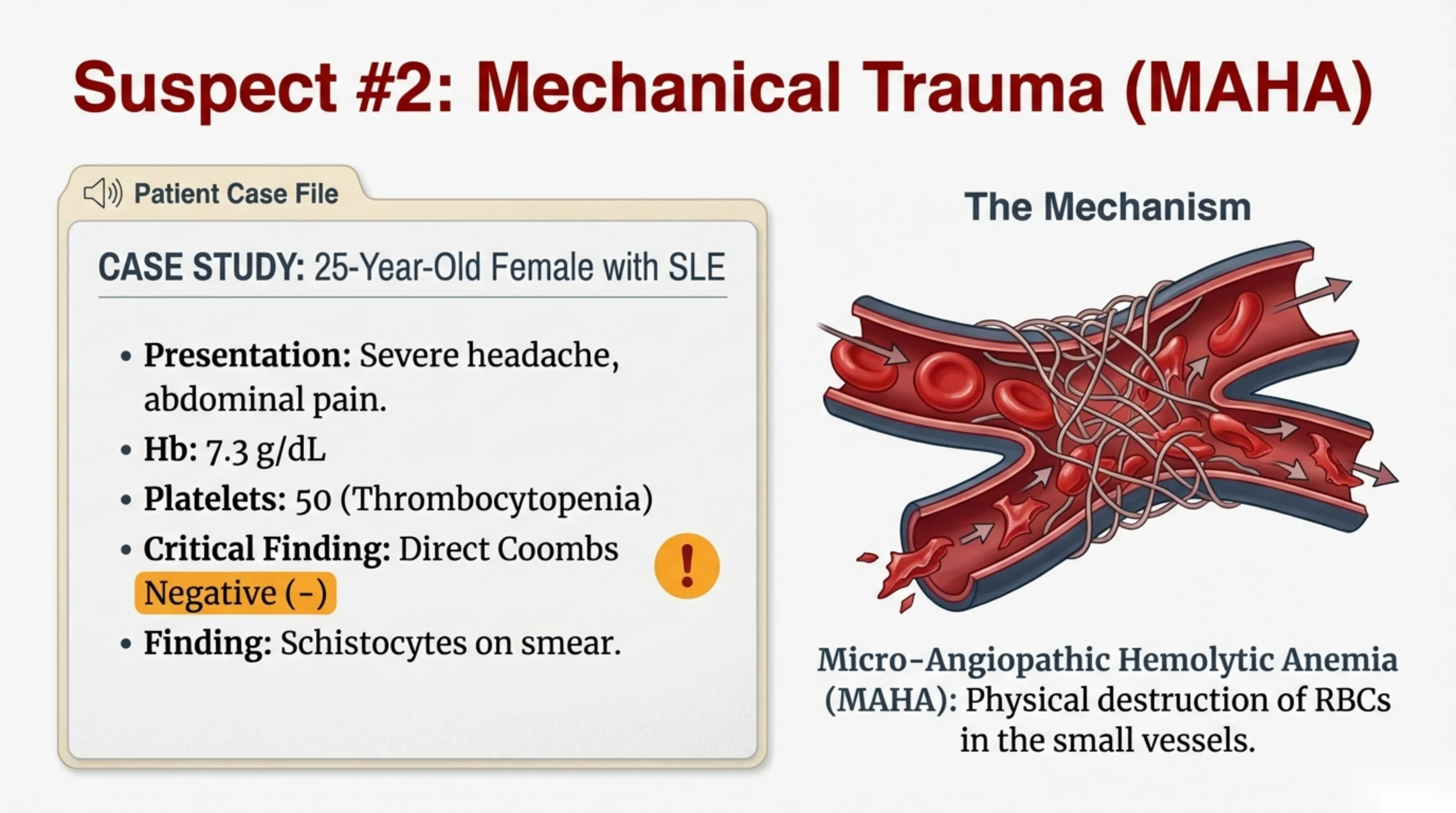 Patient case file for a 25-year-old female with SLE beside a vessel diagram showing fibrin strands shredding red blood cells.