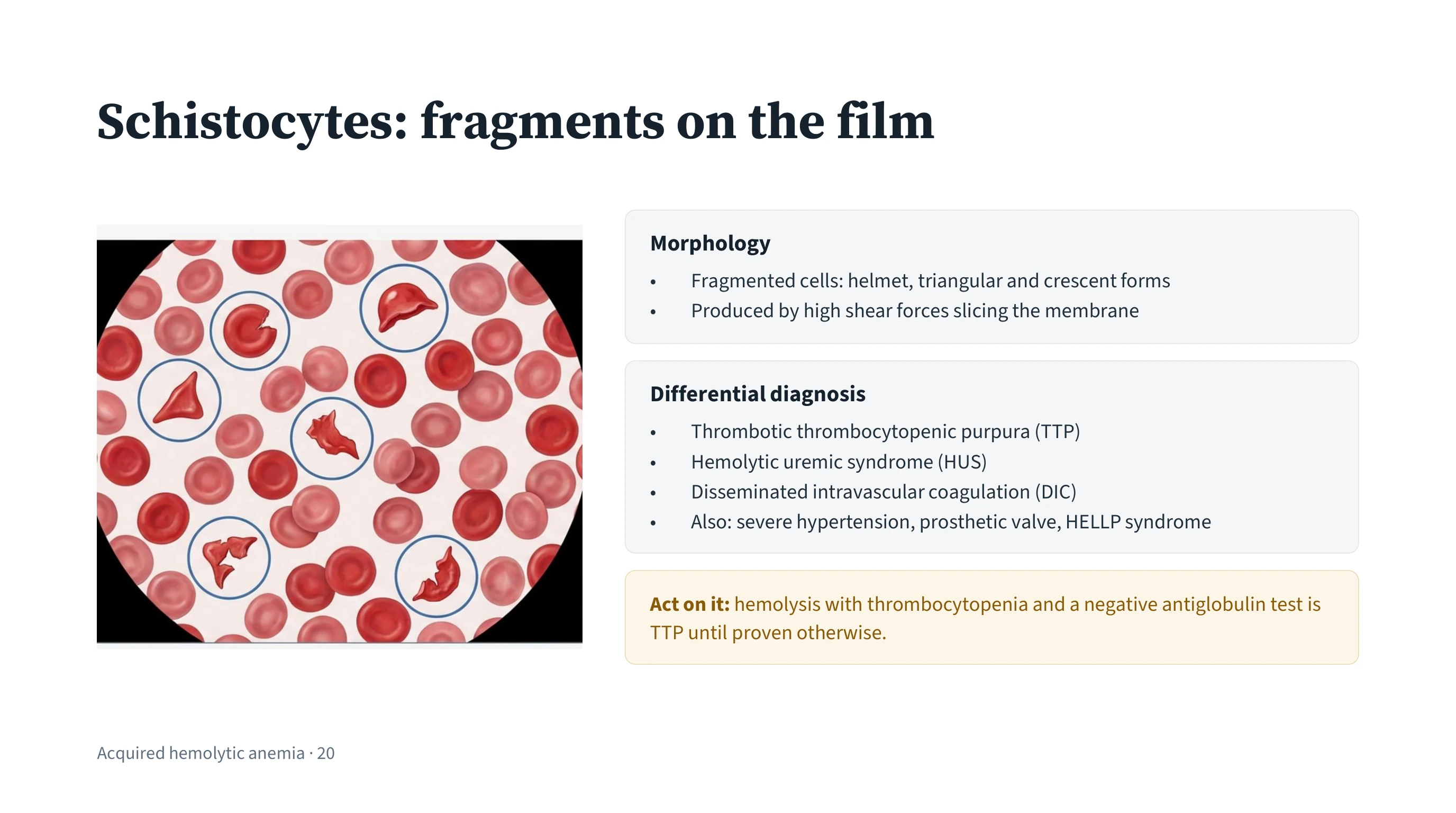 Left, a circular microscope field of a blood film with several fragmented red cells ringed, showing helmet, triangular and crescent shapes among intact cells. Right, a morphology panel, a differential diagnosis list, and a highlighted box telling the reader to act.