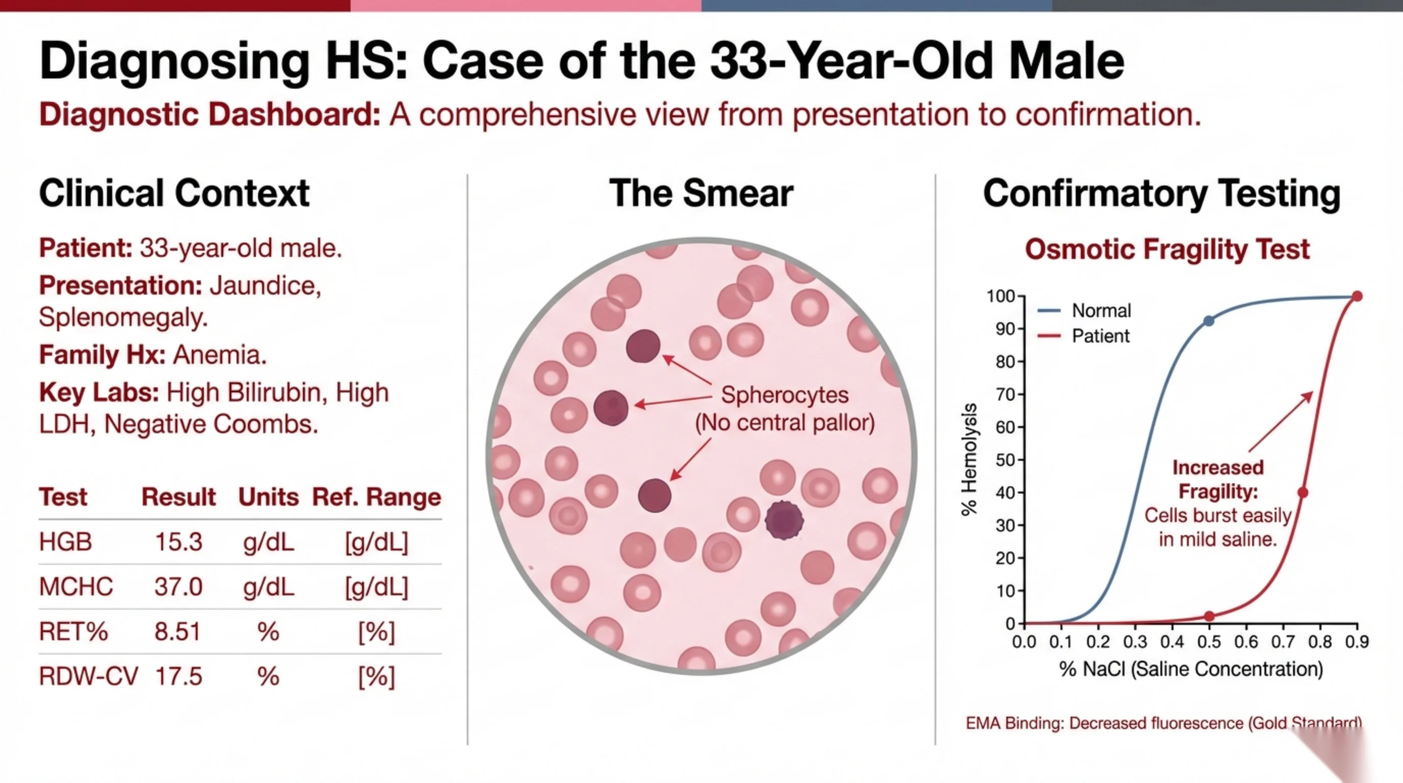Three-panel diagnostic dashboard: clinical context with a labs table, a blood smear showing spherocytes, and an osmotic fragility test graph comparing normal and patient curves.