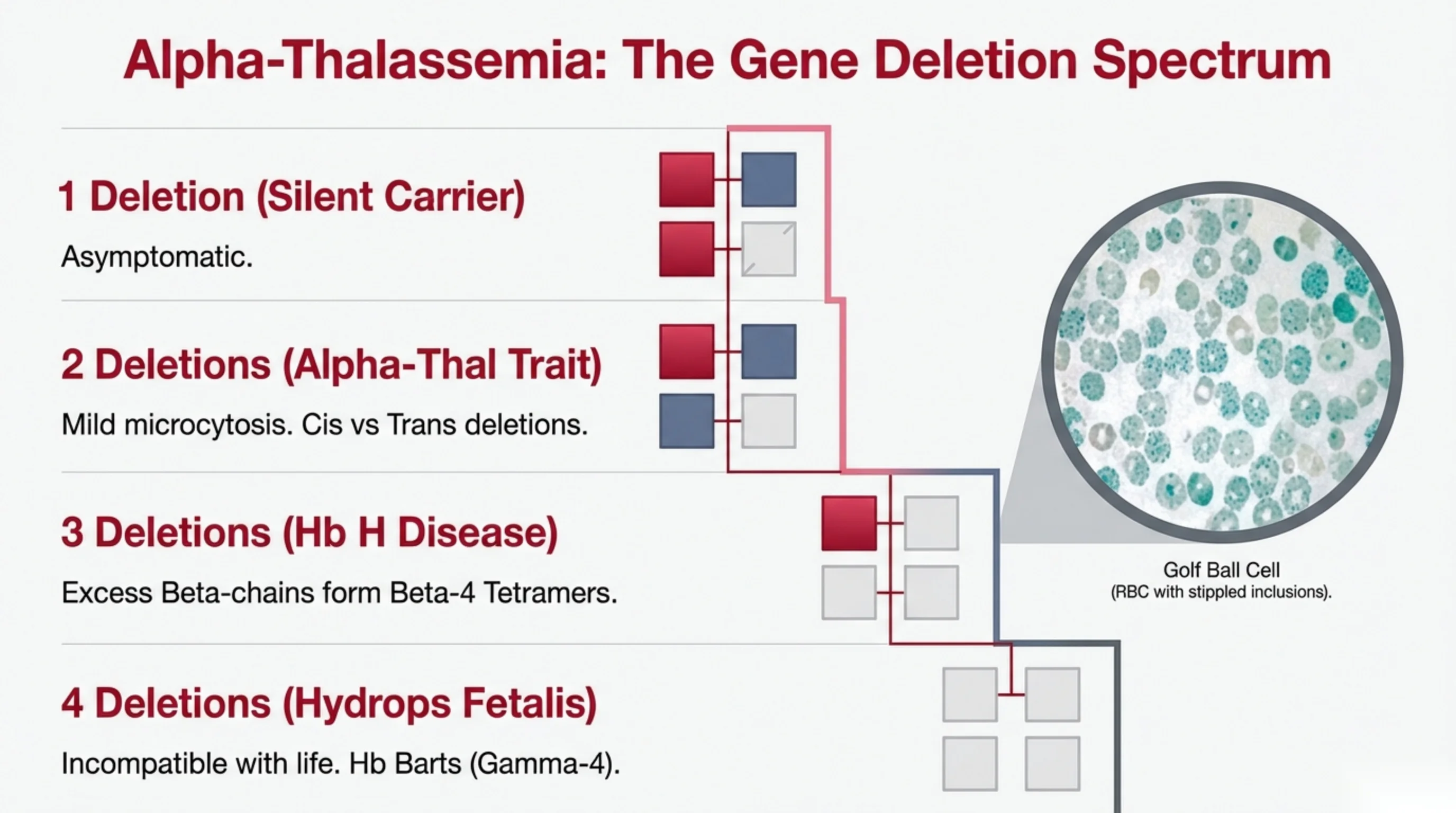 Four severity levels of alpha-globin gene deletion shown with paired gene-box diagrams, plus an inset micrograph of a golf ball cell.