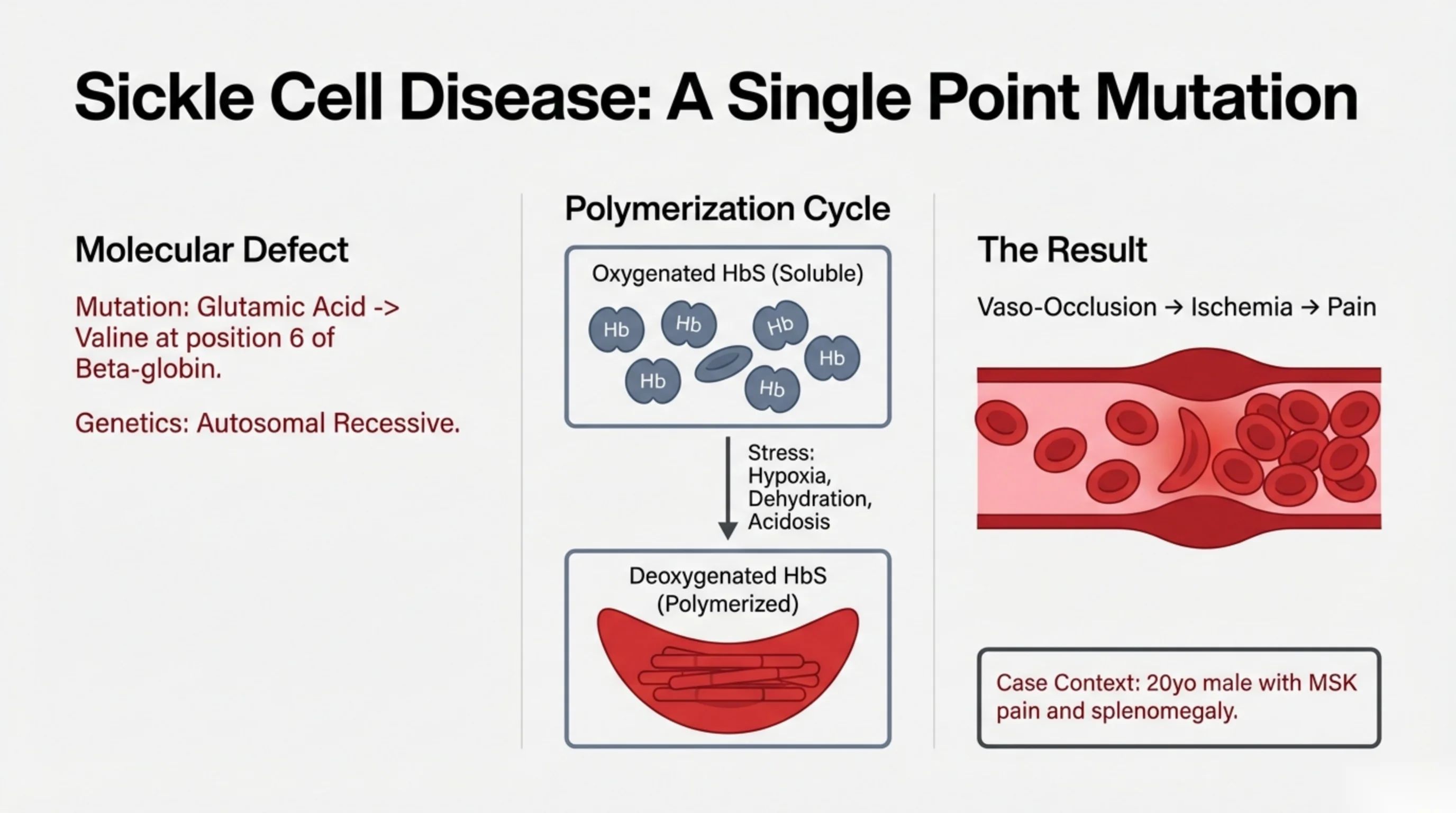 Three panels: molecular defect text, a polymerization cycle showing soluble oxygenated HbS converting to polymerized deoxygenated HbS, and a vessel showing vaso-occlusion.