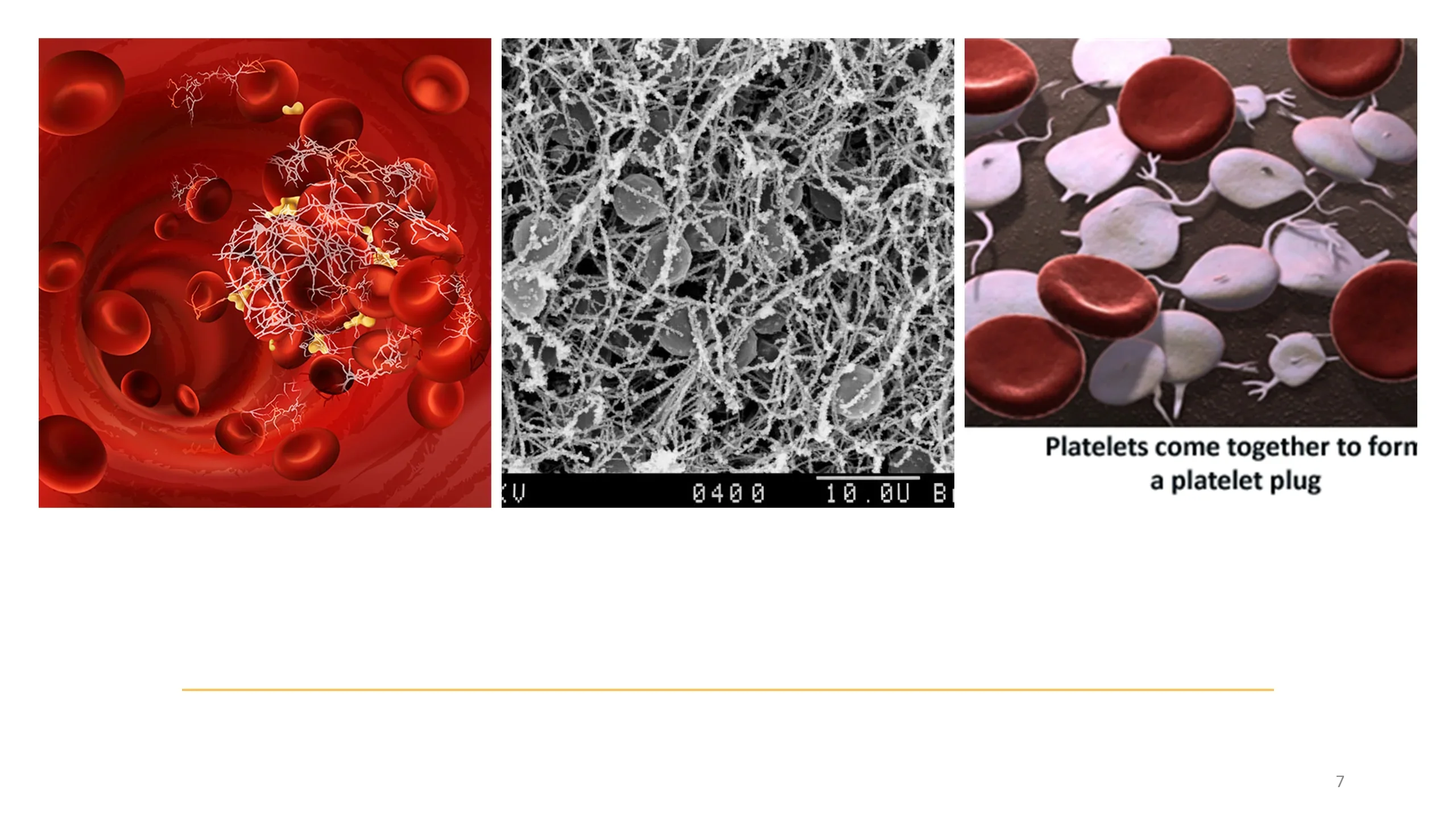 Three images: an illustration of a clot with red cells and fibrin strands, a scanning electron micrograph of a fibrin mesh with trapped cells (scale 10.0U), and photomicrograph of platelets aggregating.
