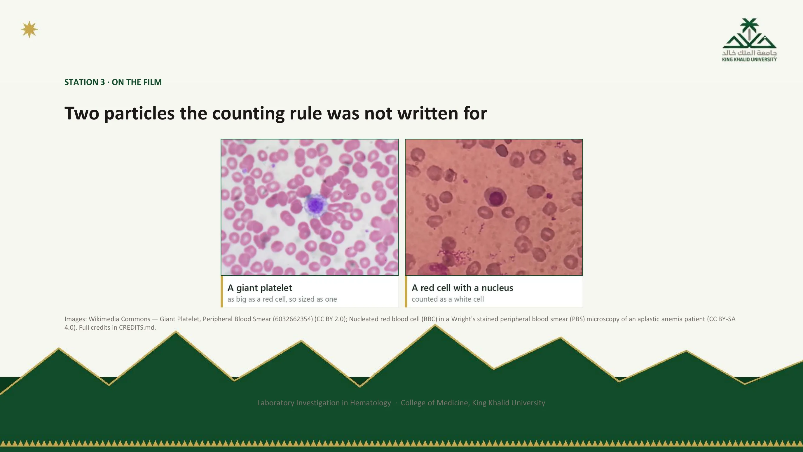 Two photomicrographs: a giant platelet as large as a red cell, which the analyser sizes as a red cell, and a nucleated red blood cell, which the analyser counts as a white cell.