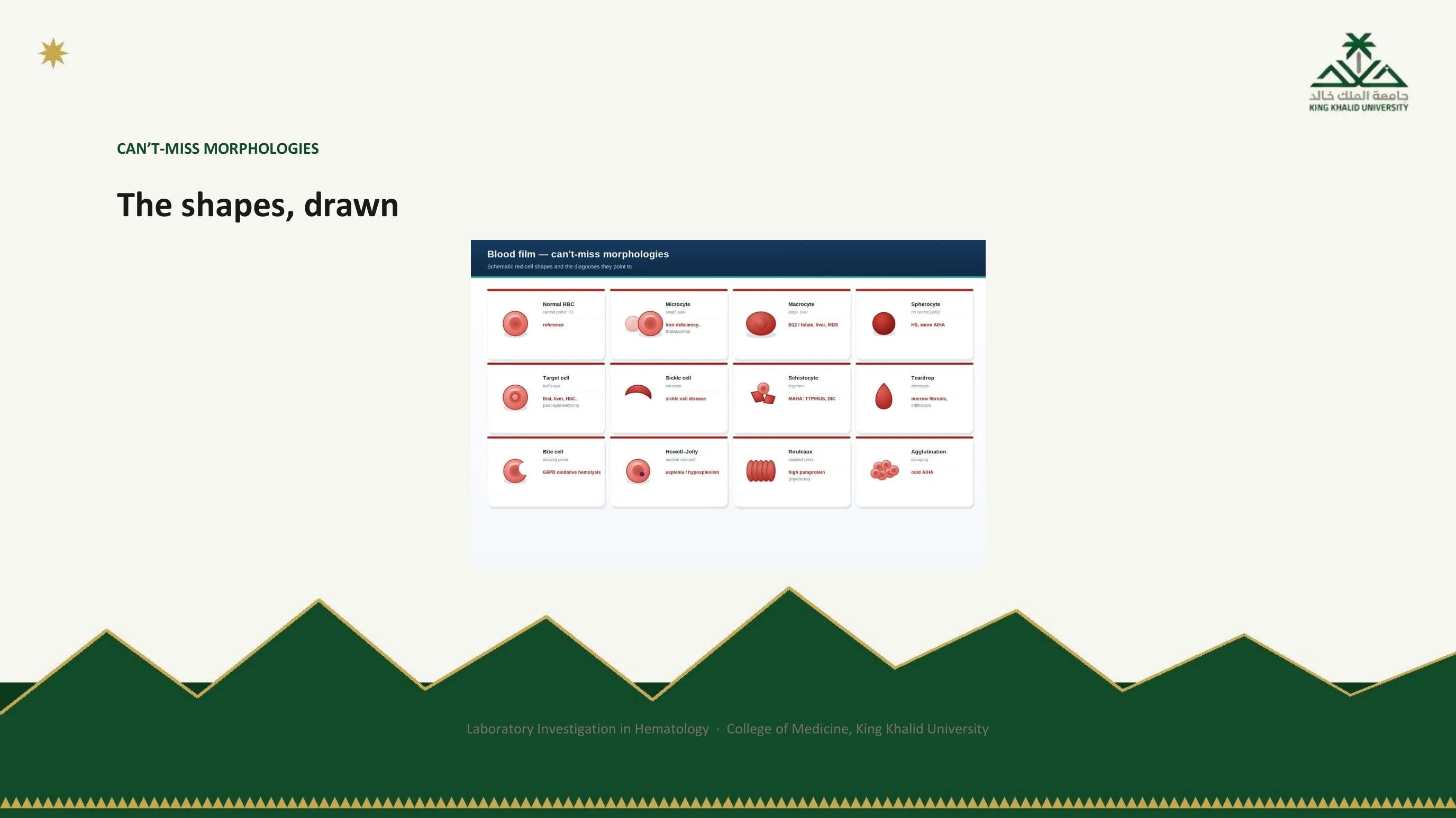Figure reproducing a handbook plate of twelve drawn red cell shapes, from normal and microcyte through schistocyte, spherocyte, target cell, tear-drop, sickle cell, Howell-Jolly body and rouleaux, each with the diagnosis it points to.
