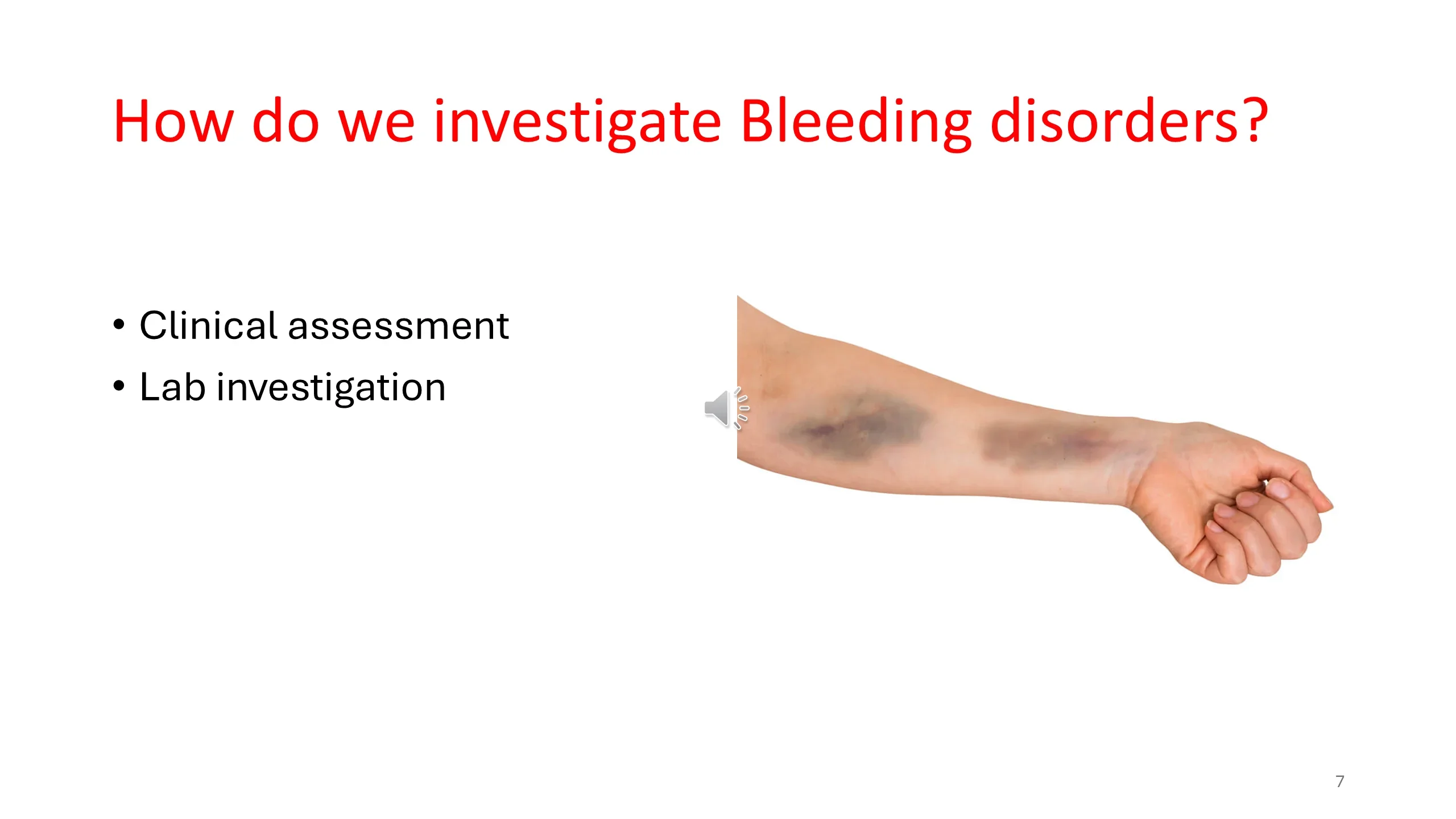 Slide titled "How do we investigate Bleeding disorders?" with two bullets beside a photo of a forearm showing bruises.
