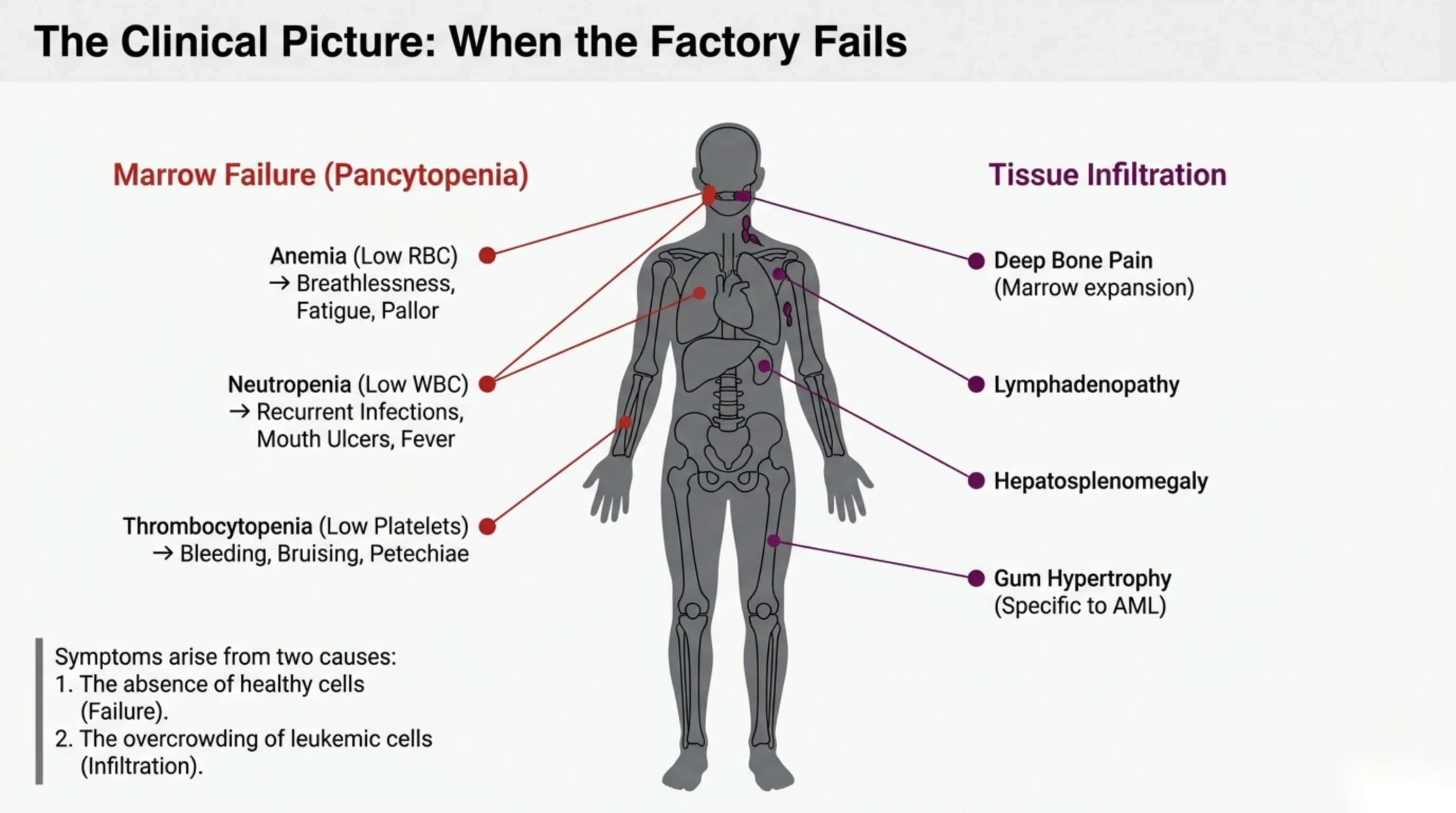 A human body figure flanked by two symptom categories, marrow failure on the left and tissue infiltration on the right, each with labeled clinical features pointing to body regions.