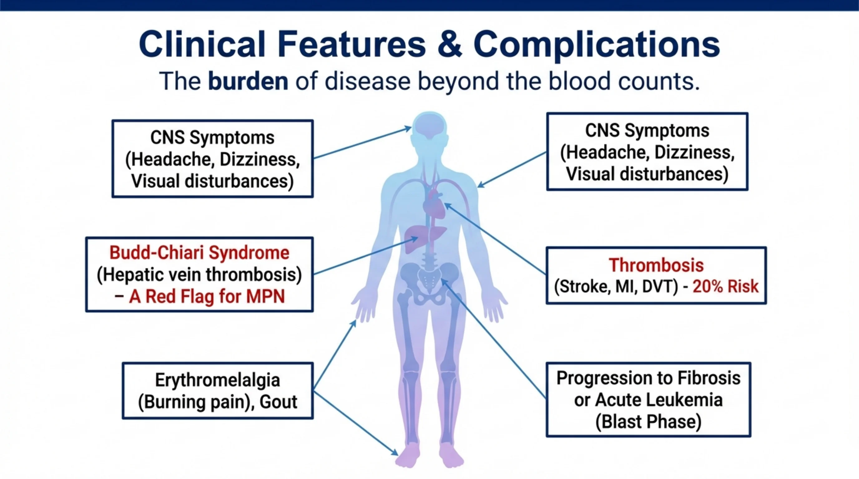 Body silhouette with labeled callouts linking MPN complications to CNS, hepatic vein, limbs, and cardiovascular sites.