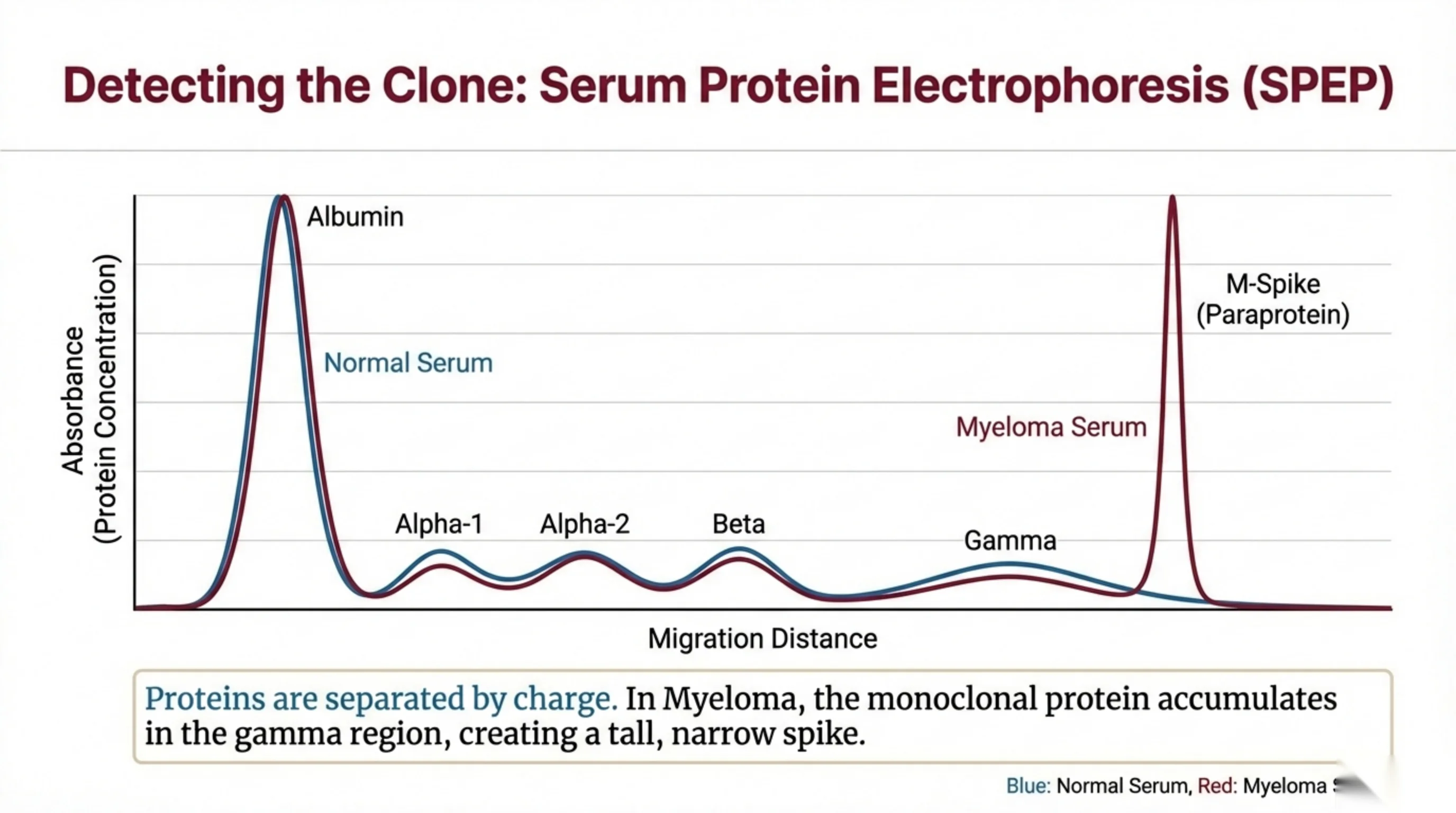 Serum protein electrophoresis graph plotting absorbance (protein concentration) against migration distance, overlaying a normal serum tracing and a myeloma serum tracing that shows a tall narrow M-spike in the gamma region.