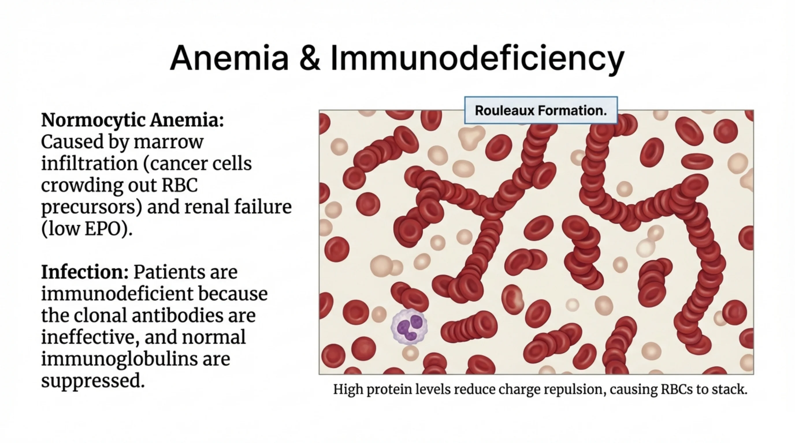 Blood smear illustration showing red blood cells stacked in chains (rouleaux formation) with a single white blood cell, alongside explanatory text.