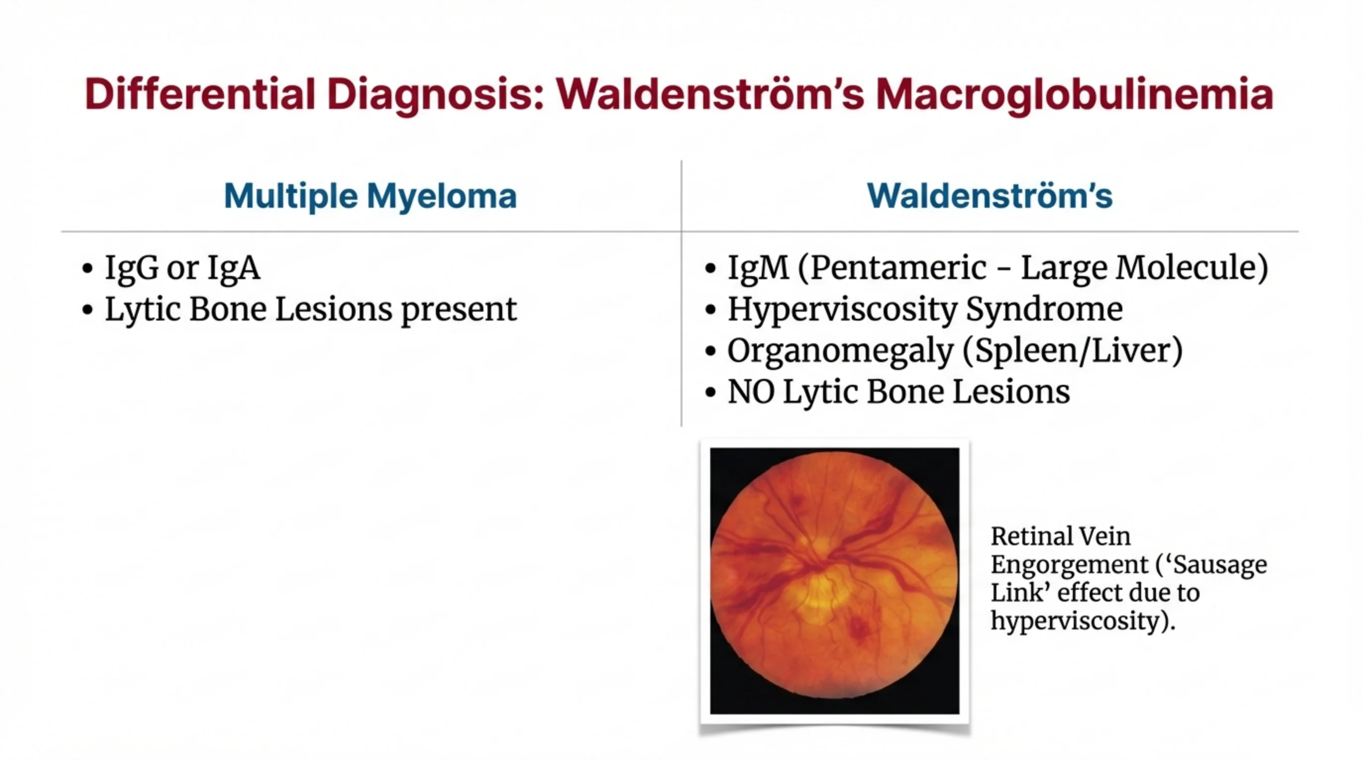 Two-column comparison table of Multiple Myeloma versus Waldenström's, with a fundus photograph showing engorged retinal veins.