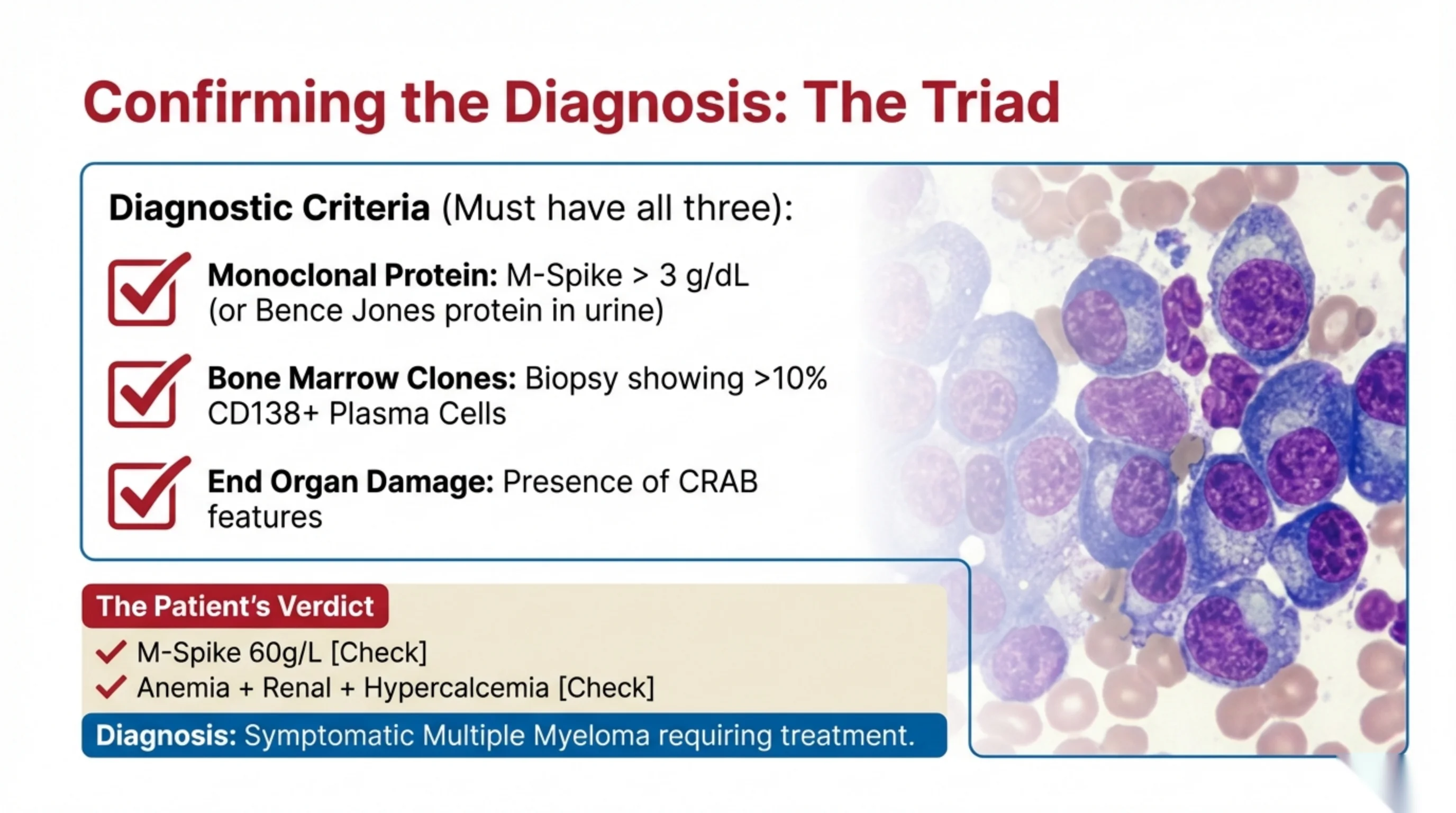 Diagnostic criteria checklist with three checked items and a Patient's Verdict box, beside a bone marrow smear showing plasma cells.